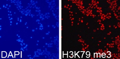 Anti-Histone H3K79me3 (tri-methyl Lys79) antibody used in Immunocytochemistry/ Immunofluorescence (ICC/IF). GTX54111