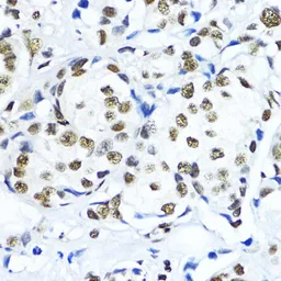 Anti-Histone H3K79me3 (tri-methyl Lys79) antibody used in IHC (Paraffin sections) (IHC-P). GTX54111