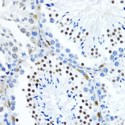 Anti-Histone H3K79me3 (tri-methyl Lys79) antibody used in IHC (Paraffin sections) (IHC-P). GTX54111