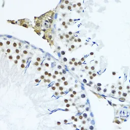 Anti-Histone H3K79me3 (tri-methyl Lys79) antibody used in IHC (Paraffin sections) (IHC-P). GTX54111