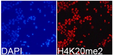 Anti-Histone H4K20me2 (di-methyl Lys20) antibody used in Immunocytochemistry/ Immunofluorescence (ICC/IF). GTX54112