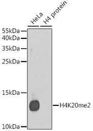 Anti-Histone H4K20me2 (di-methyl Lys20) antibody used in Western Blot (WB). GTX54112