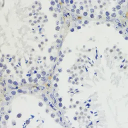 Anti-Histone H4K20me2 (di-methyl Lys20) antibody used in IHC (Paraffin sections) (IHC-P). GTX54112