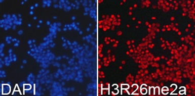 Anti-Histone H3R26me2 (Asymmetric Di-methyl Arg26) antibody used in Immunocytochemistry/ Immunofluorescence (ICC/IF). GTX54115