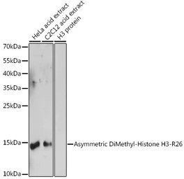 Anti-Histone H3R26me2 (Asymmetric Di-methyl Arg26) antibody used in Western Blot (WB). GTX54115