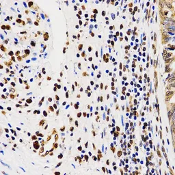 Anti-Histone H4R3me2 (di-methyl Arg3) antibody used in IHC (Paraffin sections) (IHC-P). GTX54116