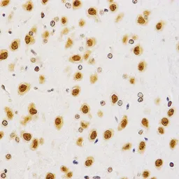 Anti-Histone H4R3me2 (di-methyl Arg3) antibody used in IHC (Paraffin sections) (IHC-P). GTX54116