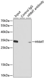 Anti-HNMT antibody used in Immunoprecipitation (IP). GTX54118