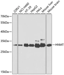 Anti-HNMT antibody used in Western Blot (WB). GTX54118