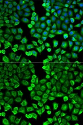 Anti-HNMT antibody used in Immunocytochemistry/ Immunofluorescence (ICC/IF). GTX54118