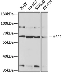 Anti-HSF2 antibody used in Western Blot (WB). GTX54125