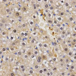 Anti-HSF2 antibody used in IHC (Paraffin sections) (IHC-P). GTX54125