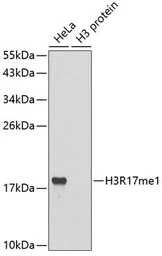 Anti-Histone H3R17me1 (mono-methyl Arg17) antibody used in Western Blot (WB). GTX54131