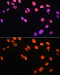 Anti-Histone H3R17me1 (mono-methyl Arg17) antibody used in Immunocytochemistry/ Immunofluorescence (ICC/IF). GTX54131