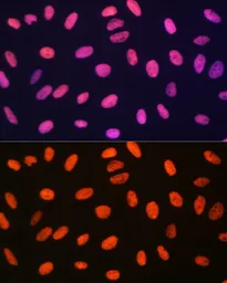 Anti-Histone H3R17me1 (mono-methyl Arg17) antibody used in Immunocytochemistry/ Immunofluorescence (ICC/IF). GTX54131