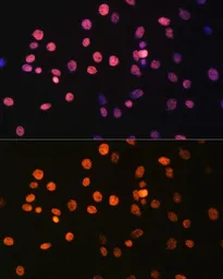Anti-Histone H3R17me1 (mono-methyl Arg17) antibody used in Immunocytochemistry/ Immunofluorescence (ICC/IF). GTX54131
