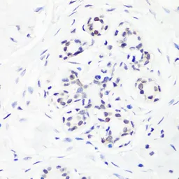 Anti-Histone H3R17me1 (mono-methyl Arg17) antibody used in IHC (Paraffin sections) (IHC-P). GTX54131