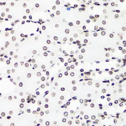 Anti-Histone H3R17me1 (mono-methyl Arg17) antibody used in IHC (Paraffin sections) (IHC-P). GTX54131