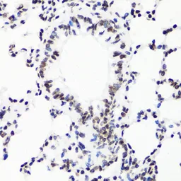 Anti-Histone H3R17me1 (mono-methyl Arg17) antibody used in IHC (Paraffin sections) (IHC-P). GTX54131