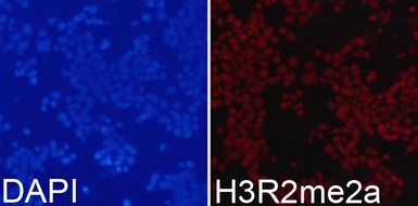 Anti-Histone H3R2me2 (Asymmetric Di-methyl Arg2) antibody used in Immunocytochemistry/ Immunofluorescence (ICC/IF). GTX54134