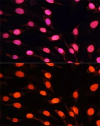 Anti-Histone H3R2me2 (Asymmetric Di-methyl Arg2) antibody used in Immunocytochemistry/ Immunofluorescence (ICC/IF). GTX54134
