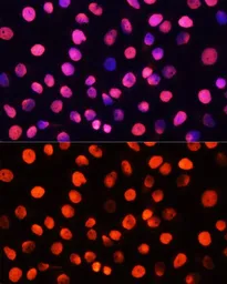 Anti-Histone H3R2me2 (Asymmetric Di-methyl Arg2) antibody used in Immunocytochemistry/ Immunofluorescence (ICC/IF). GTX54134