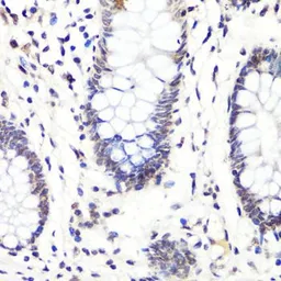 Anti-Histone H3R2me2 (Asymmetric Di-methyl Arg2) antibody used in IHC (Paraffin sections) (IHC-P). GTX54134
