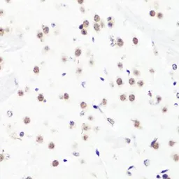 Anti-Histone H3R2me2 (Asymmetric Di-methyl Arg2) antibody used in IHC (Paraffin sections) (IHC-P). GTX54134