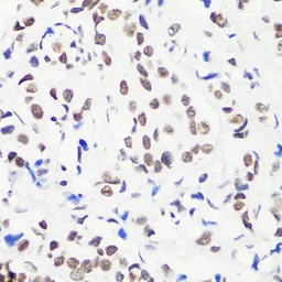Anti-Histone H3R8me1 (mono-methyl Arg8) antibody used in IHC (Paraffin sections) (IHC-P). GTX54135