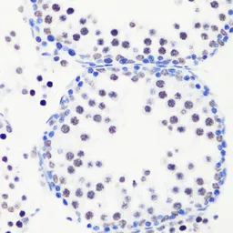 Anti-Histone H3R8me1 (mono-methyl Arg8) antibody used in IHC (Paraffin sections) (IHC-P). GTX54135