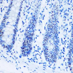 Anti-Histone H3R8me2 (Asymmetric Di-methyl Arg8) antibody used in IHC (Paraffin sections) (IHC-P). GTX54136