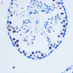 Anti-Histone H3R8me2 (Asymmetric Di-methyl Arg8) antibody used in IHC (Paraffin sections) (IHC-P). GTX54136