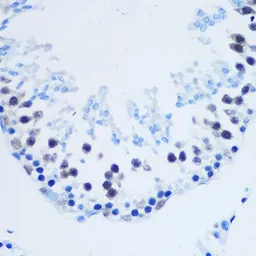 Anti-Histone H3R8me2 (Asymmetric Di-methyl Arg8) antibody used in IHC (Paraffin sections) (IHC-P). GTX54136