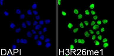 Anti-Histone H3R26me1 (mono-methyl Arg26) antibody used in Immunocytochemistry/ Immunofluorescence (ICC/IF). GTX54139