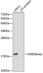 Anti-Histone H3R26me1 (mono-methyl Arg26) antibody used in Western Blot (WB). GTX54139