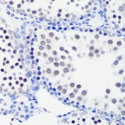 Anti-Histone H3R26me1 (mono-methyl Arg26) antibody used in IHC (Paraffin sections) (IHC-P). GTX54139
