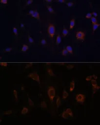 Anti-Glutaredoxin 1 antibody used in Immunocytochemistry/ Immunofluorescence (ICC/IF). GTX54140