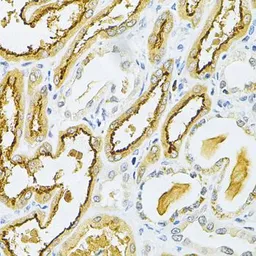 Anti-Glutaredoxin 1 antibody used in IHC (Paraffin sections) (IHC-P). GTX54140