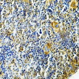Anti-Glutaredoxin 1 antibody used in IHC (Paraffin sections) (IHC-P). GTX54140