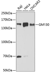 Anti-GM130 antibody used in Western Blot (WB). GTX54142
