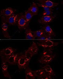 Anti-GM130 antibody used in Immunocytochemistry/ Immunofluorescence (ICC/IF). GTX54142
