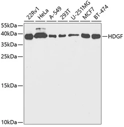 Anti-HDGF antibody used in Western Blot (WB). GTX54144