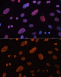 Anti-HDGF antibody used in Immunocytochemistry/ Immunofluorescence (ICC/IF). GTX54144