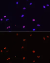 Anti-HDGF antibody used in Immunocytochemistry/ Immunofluorescence (ICC/IF). GTX54144