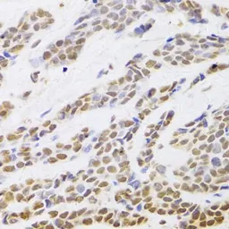 Anti-HDGF antibody used in IHC (Paraffin sections) (IHC-P). GTX54144