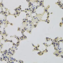 Anti-HDGF antibody used in IHC (Paraffin sections) (IHC-P). GTX54144
