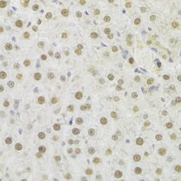 Anti-HDGF antibody used in IHC (Paraffin sections) (IHC-P). GTX54144
