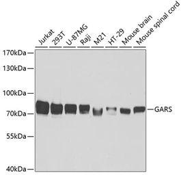 Anti-GARS antibody used in Western Blot (WB). GTX54147