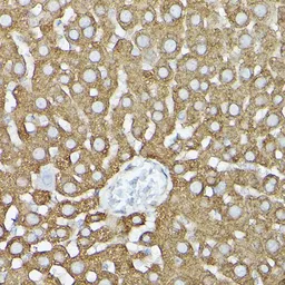 Anti-GARS antibody used in Immunocytochemistry/ Immunofluorescence (ICC/IF). GTX54147