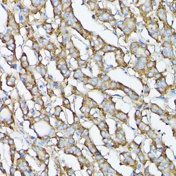 Anti-GARS antibody used in IHC (Paraffin sections) (IHC-P). GTX54147